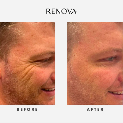 Renova Tallow Reborn™ – Anti-Aging Face Cream