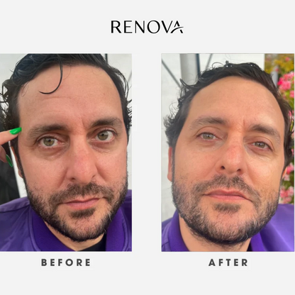 Renova Tallow Reborn™ – Anti-Aging Face Cream